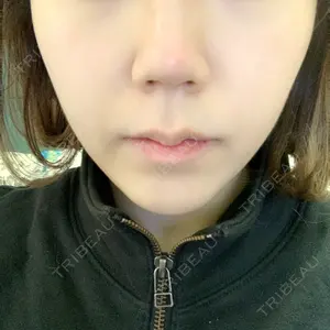 201 days after image