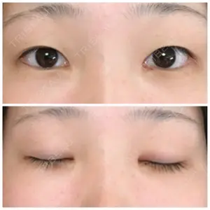 57 days after image