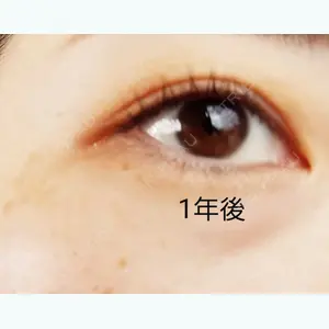 343 days after image