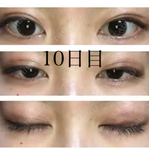 10 days after image