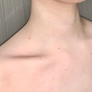 473 days after image
