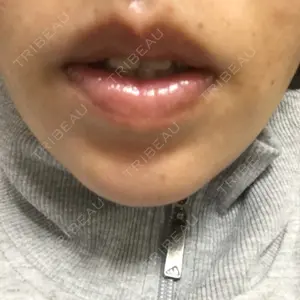 6 days after image