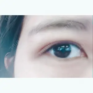 15 days after image