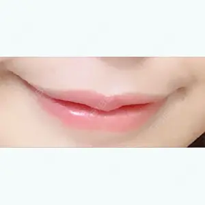 170 days after image