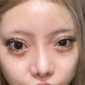 HANABI整形外科口コミ