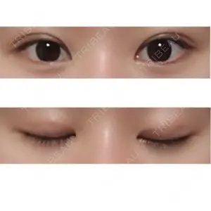 32 days after image
