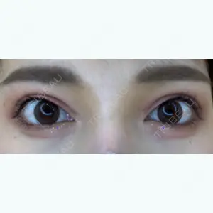 106 days after image