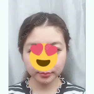 103 days after image