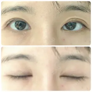 118 days after image