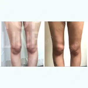 34 days after image