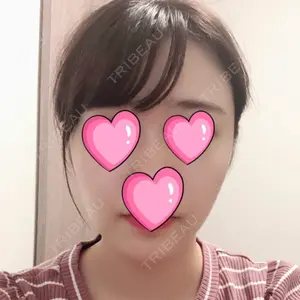 67 days after image
