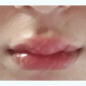 9 days after image