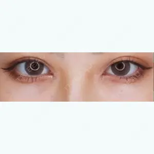 48 days after image