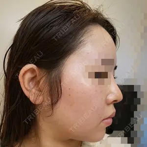 La Clinique Shinjuku【ラクリニック新宿】（旧：銀座長瀬クリニック）の長瀬 ⼤蔵医師口コミ