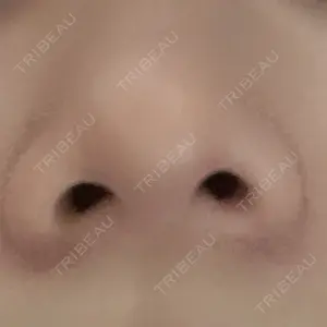 43 days after image