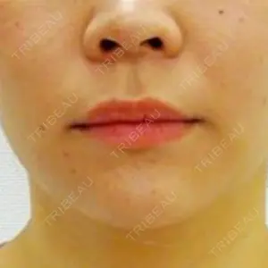 57 days after image