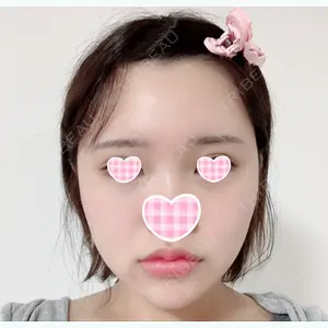 30 days after image