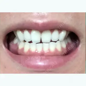 377 days after image