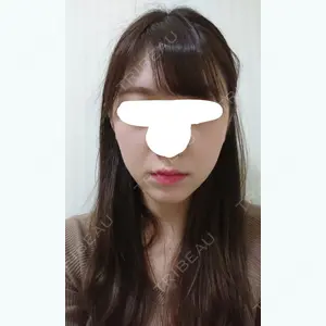 39 days after image