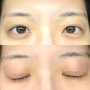 17 days after image