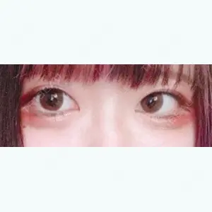 579 days after image