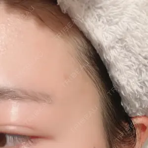 26 days after image