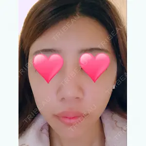 200 days after image