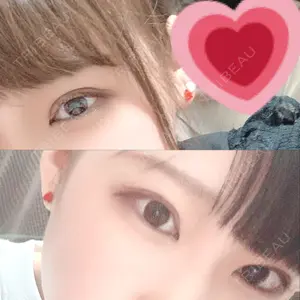 341 days after image
