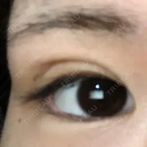 8 days after image