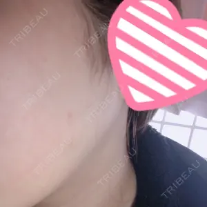 46 days after image
