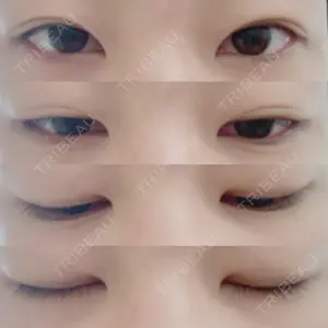 共立美容外科 新宿本院の新妻 克宜医師口コミ