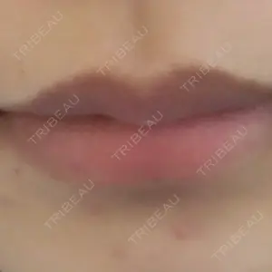8 days after image