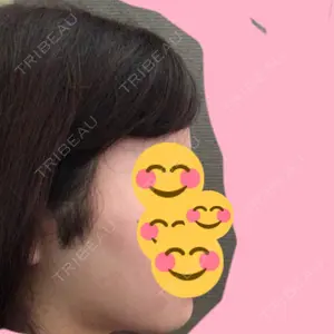 153 days after image
