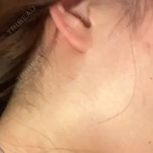344 days after image