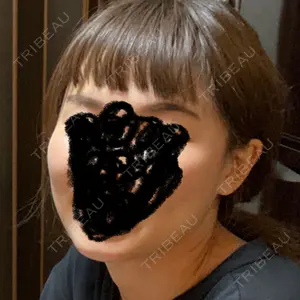 湘南美容クリニック 湘南美容クリニック大阪駅前院（女性限定院）口コミ