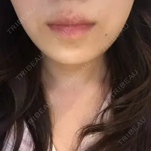 20 days after image