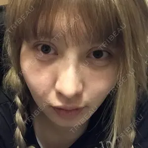 94 days after image