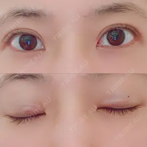 湘南美容クリニック 湘南美容クリニック Regno 銀座院口コミ