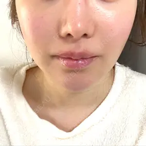 湘南美容クリニック 湘南美容クリニック渋谷アネックス院口コミ