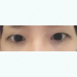 4264 days after image