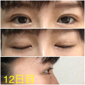 12 days after image