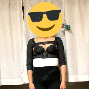 2 days after image