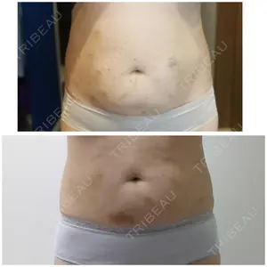 8 days after image