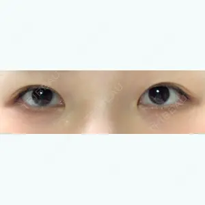 753 days after image