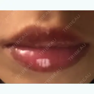 31 days after image