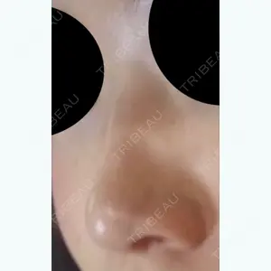 140 days after image