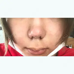 湘南美容クリニック 神戸院の小川 元医師口コミ