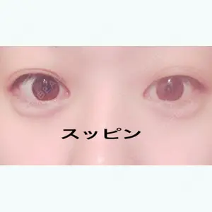 2 days after image