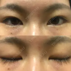 238 days after image