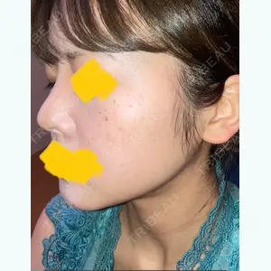 1135 days after image